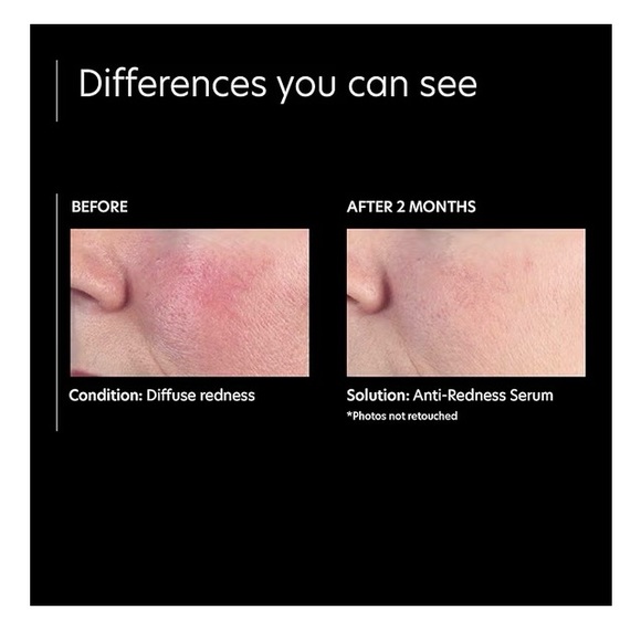 PCA Skin Anti-Redness Serum - Picture 5 of 7